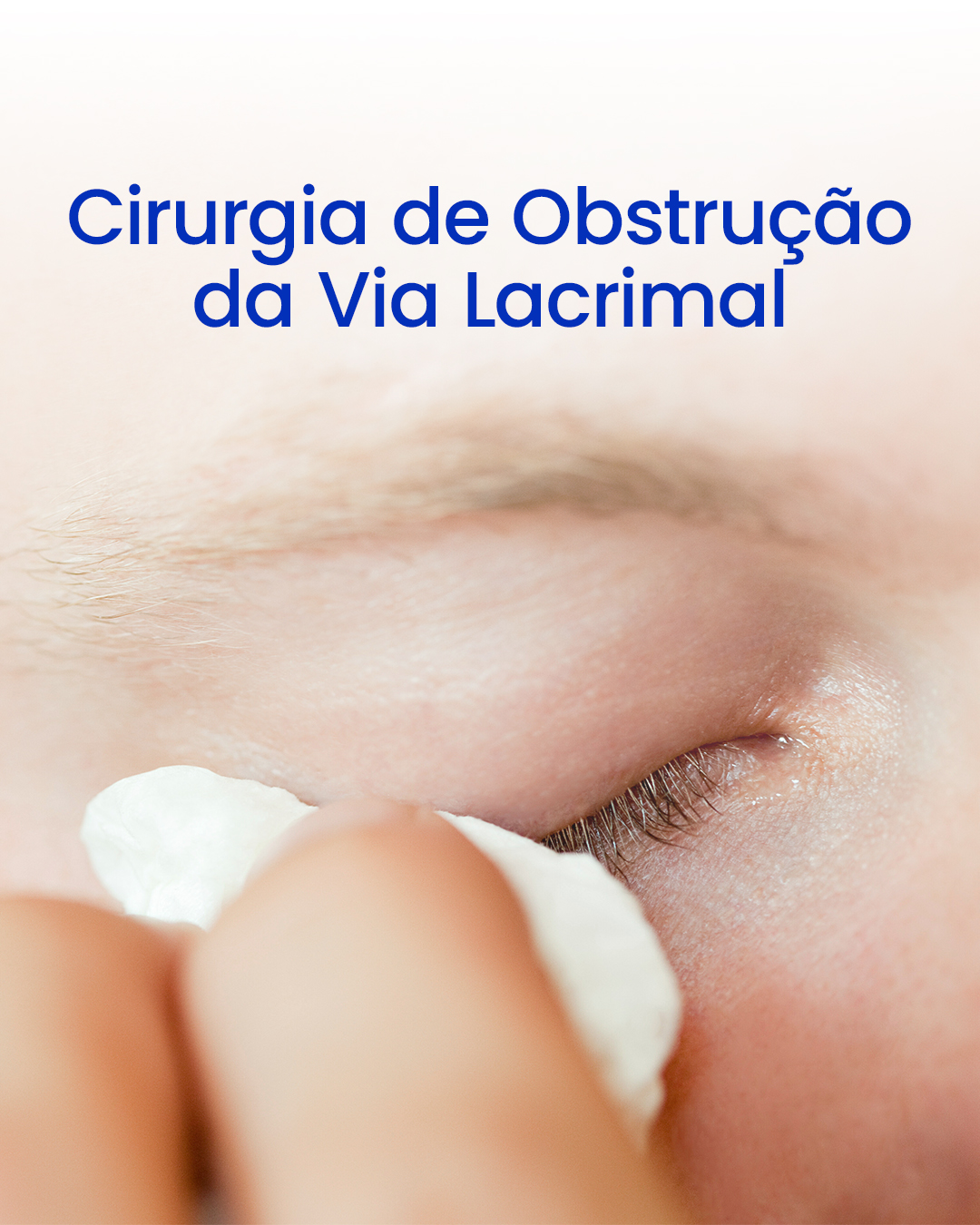 Cirurgia de Obstrução da Via Lacrimal